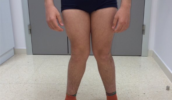 alteraciones-del-crecimiento